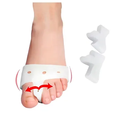 Hallux valgus (2st)